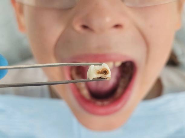 Best Knocked-Out Tooth Emergency  in Haleiwa, HI